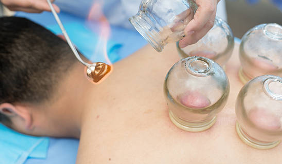 Discover the Best Cupping Massage Near Me